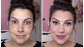 FULL COVERAGE Makeup for Melasma & Discoloration