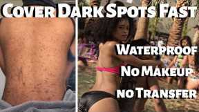 How To Get Rid of Dark Spots FAST | Cover Dark Spots WITHOUT makeup