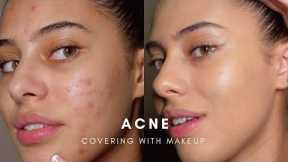 HOW TO: COVER ACNE WITH MAKEUP (BASE ROUTINE)